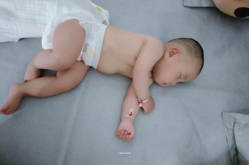 运城宝宝头上长痱子